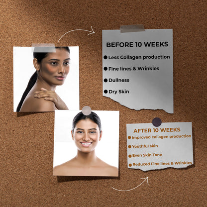 Cezorn Skin Radiance Collagen Builder 800mg Capsules | Supports Healthy Skin, Stronger Hair, Nails & Joints | 60 Capsules